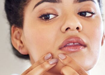 Éviter l’Acné du Stress