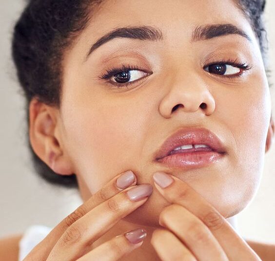 Éviter l’Acné du Stress